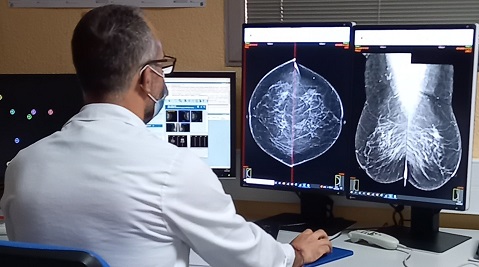 El Hospital ‘San Agustín’ de Linares realiza 4.812 mamografías en el primer semestre del año.