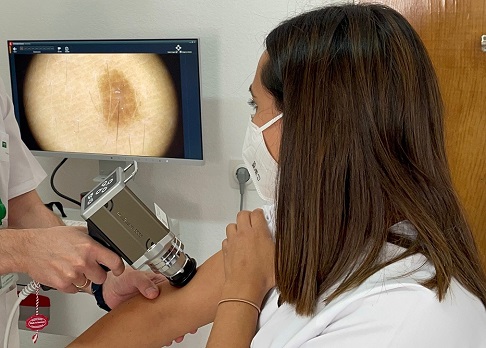 El Hospital de Jaén diagnóstica en torno a 400 casos de cáncer de piel en lo que va de año 2023.