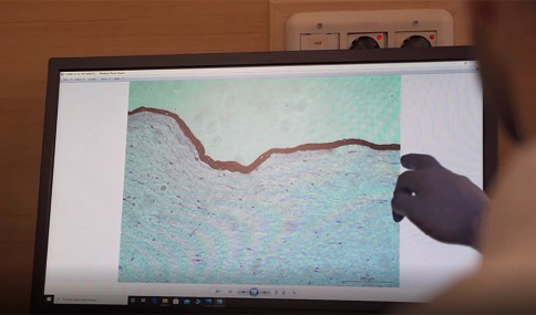 Una fábrica de medicamentos celulares y de tejidos en el Virgen de las Nieves que cura y da esperanza.