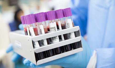 Sanidad anima a donar en Navidad tras superar las 250.000 muestras de sangre obtenidas en 2025.